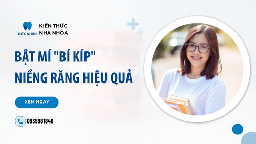 Bật mí các lưu ý khi niềng răng mà đồng niềng nào cũng cần biết